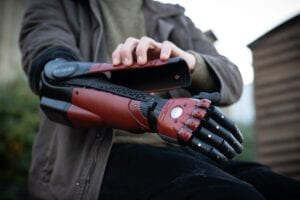 Open Bionics Metal Gear Prosthetic